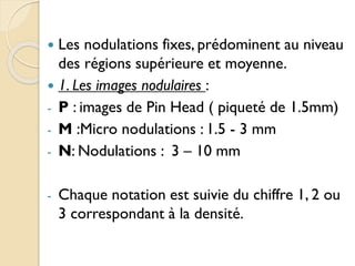  Les nodulations fixes, prédominent au niveau
des régions supérieure et moyenne.
 1. Les images nodulaires :
- P : images de Pin Head ( piqueté de 1.5mm)
- M :Micro nodulations : 1.5 - 3 mm
- N: Nodulations : 3 – 10 mm
- Chaque notation est suivie du chiffre 1, 2 ou
3 correspondant à la densité.
 
