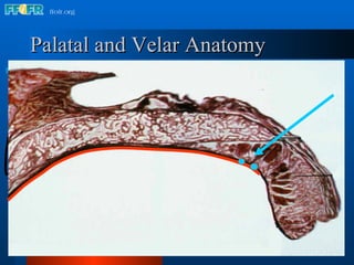 Palatal and Velar Anatomy Posterior Palatal Seal Velum Glandular tissue 