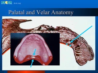 Palatal and Velar Anatomy Posterior Palatal Seal Velum Glandular tissue 