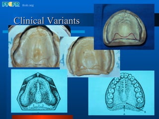 Clinical Variants 