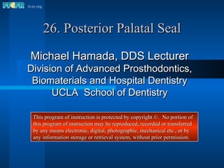 26. Posterior Palatal Seal Michael Hamada, DDS Lecturer Division of Advanced Prosthodontics, Biomaterials and Hospital Dentistry UCLA  School of Dentistry This program of instruction is protected by copyright ©.  No portion of this program of instruction may be reproduced, recorded or transferred by any means electronic, digital, photographic, mechanical etc., or by any information storage or retrieval system, without prior permission. 