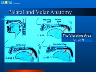 Palatal and Velar Anatomy The Vibrating Area or Line 