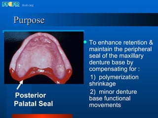 Purpose To enhance retention & maintain the peripheral seal of the maxillary denture base by compensating for : 1)  polymerization  shrinkage 2)  minor denture  base functional  movements Posterior Palatal Seal 