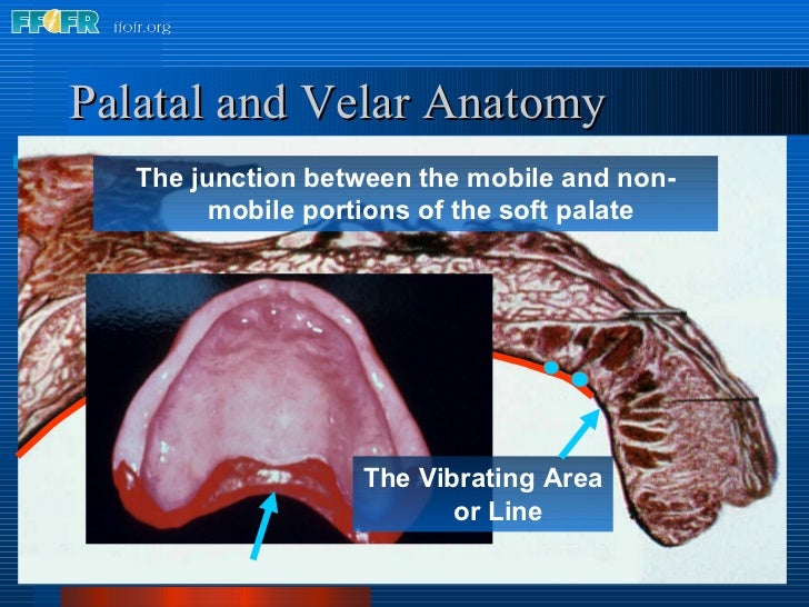posterior palatal seal