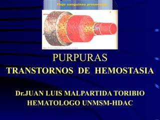 PURPURAS TRANSTORNOS  DE  HEMOSTASIA Dr.JUAN LUIS MALPARTIDA TORIBIO HEMATOLOGO UNMSM-HDAC 