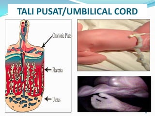 TALI PUSAT/UMBILICAL CORD
14
 