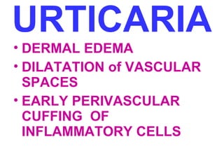 URTICARIA 
• DERMAL EDEMA 
• DILATATION of VASCULAR 
SPACES 
• EARLY PERIVASCULAR 
CUFFING OF 
INFLAMMATORY CELLS 
 
