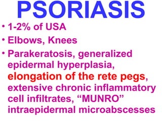 PSORIASIS • 1-2% of USA 
• Elbows, Knees 
• Parakeratosis, generalized 
epidermal hyperplasia, 
elongation of the rete pegs, 
extensive chronic inflammatory 
cell infiltrates, “MUNRO” 
intraepidermal microabscesses 
 