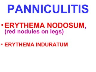PANNICULITIS 
•ERYTHEMA NODOSUM, 
(red nodules on legs) 
• ERYTHEMA INDURATUM 
 