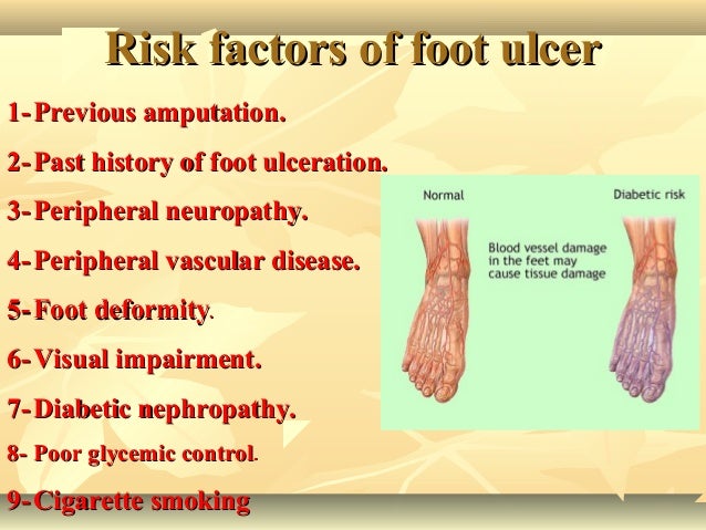 Risk Factors For Diabetic Foot Ulcer Diabeteswalls