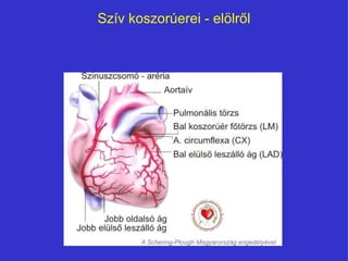 Szív koszorúerei - öő 