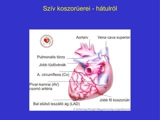 Szív koszorúerei - áٳܱó 