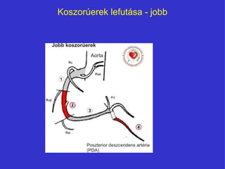 Koszorúerek lefutása - jobb 
