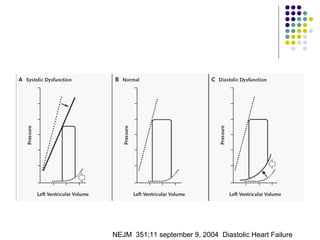 NEJM  351;11 september 9, 2004  Diastolic Heart Failure 