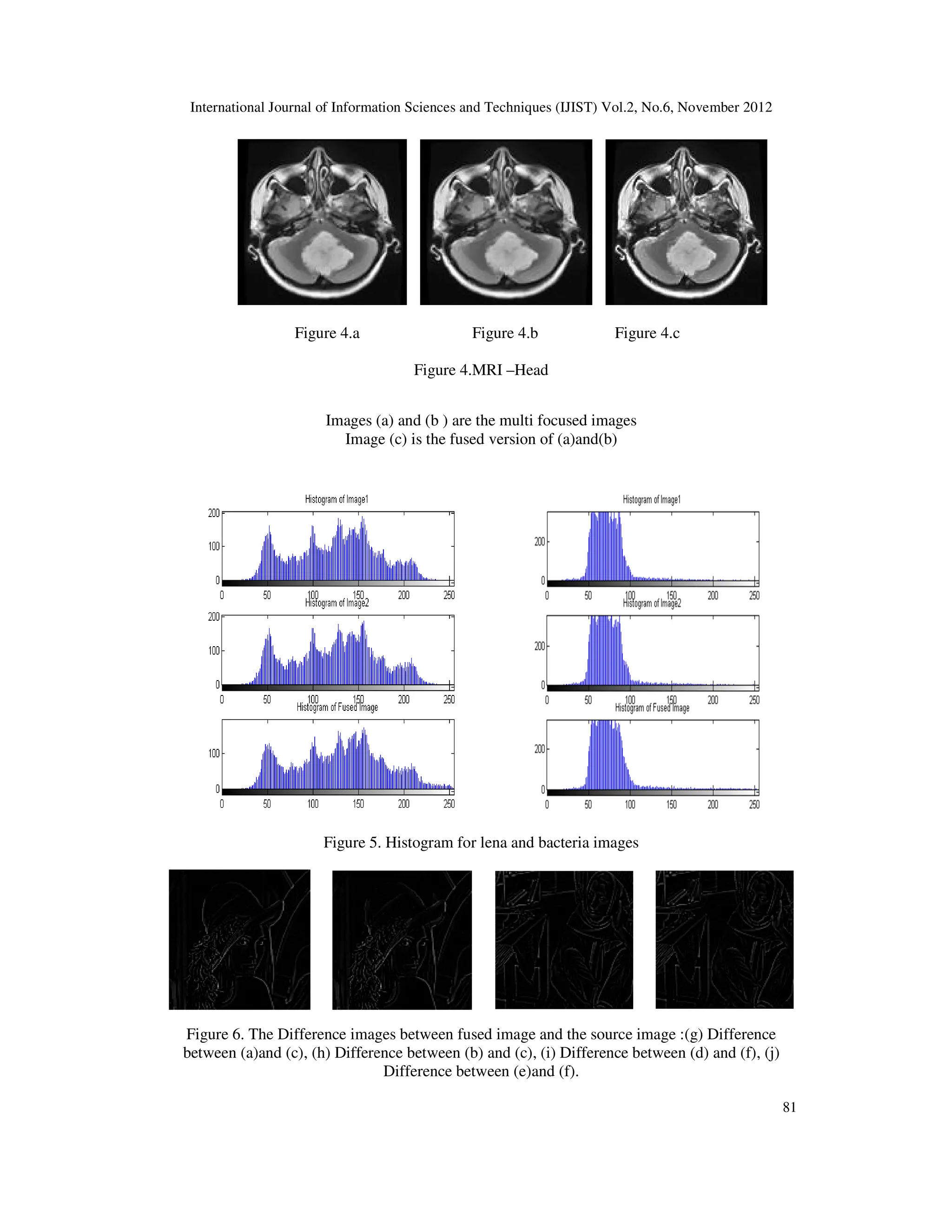 International Journal of Information Sciences and Techniques (IJIST) Vol.2, No.6, November 2012
Figure 4.a
Images (a) and (b ) are the multi focused images
Image (c) is the fused version of (a)and(b)
Figure 5. Histogram for lena and bacteria images
Figure 6. The Difference images between
between (a)and (c), (h) Difference between (b) and (c), (i) Difference between (d) and (f), (j)
International Journal of Information Sciences and Techniques (IJIST) Vol.2, No.6, November 2012
4.a Figure 4.b Figure 4.c
Figure 4.MRI –Head
Images (a) and (b ) are the multi focused images
Image (c) is the fused version of (a)and(b)
Figure 5. Histogram for lena and bacteria images
Figure 6. The Difference images between fused image and the source image :(g) Difference
between (a)and (c), (h) Difference between (b) and (c), (i) Difference between (d) and (f), (j)
Difference between (e)and (f).
International Journal of Information Sciences and Techniques (IJIST) Vol.2, No.6, November 2012
81
fused image and the source image :(g) Difference
between (a)and (c), (h) Difference between (b) and (c), (i) Difference between (d) and (f), (j)
 