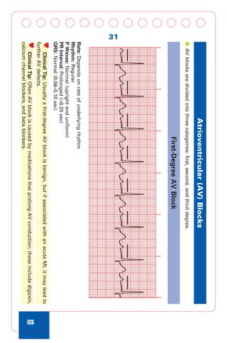 Dont Downloaddefect Acls Cpr And Pals Clinical Pocket Guide First Jones ...