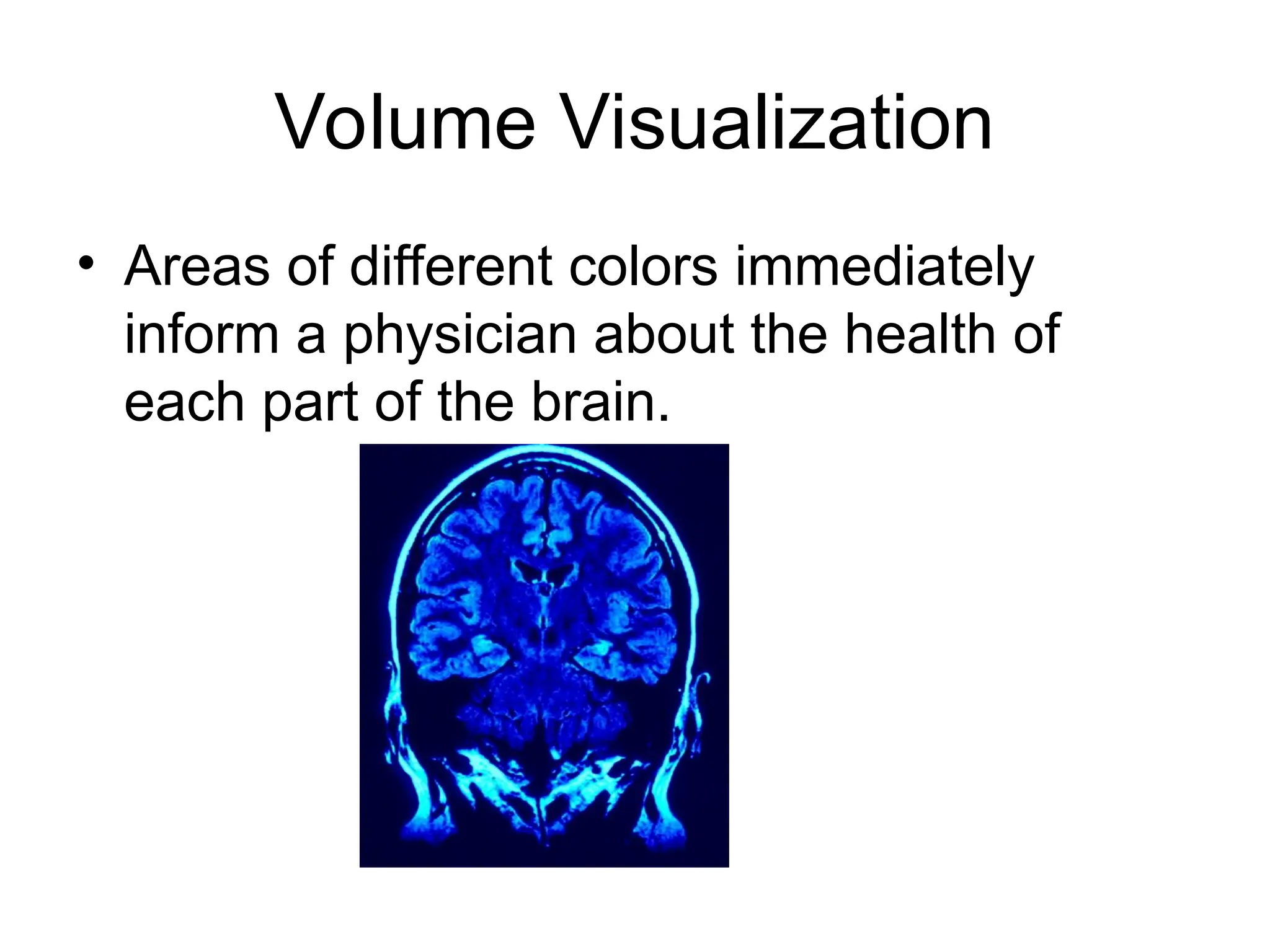 Volume Visualization
• Areas of different colors immediately
inform a physician about the health of
each part of the brain.
 