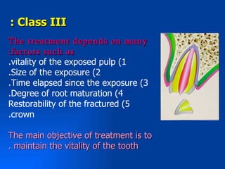 : Class III
The treatment depends on many
:factors such as
.vitality of the exposed pulp (1
.Size of the exposure (2
.Time elapsed since the exposure (3
.Degree of root maturation (4
Restorability of the fractured (5
.crown

The main objective of treatment is to
. maintain the vitality of the tooth
 