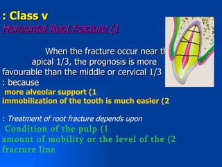 : Class v
Horizontal Root fracture (1

           When the fracture occur near the
       apical 1/3, the prognosis is more
favourable than the middle or cervical 1/3
: because
 more alveolar support (1
immobilization of the tooth is much easier (2

: Treatment of root fracture depends upon
 Condition of the pulp (1
amount of mobility or the level of the (2
fracture line
 