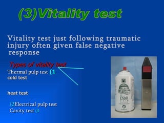 Vitality test just following traumatic
injury often given false negative
response
Types of vitality test
Thermal pulp test (1
cold test


heat test

 (2Electrical pulp test
 Cavity test (3
 