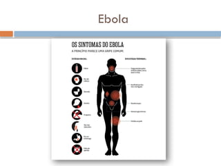 Ebola
 