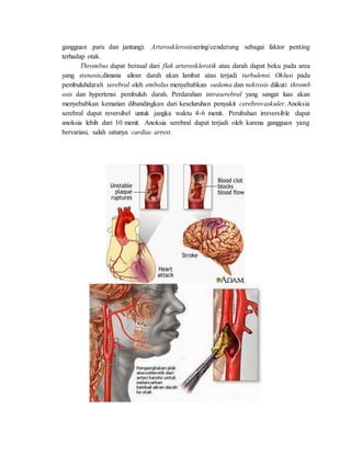 Drag each label to the appropriate location on this diagram of the human respiratory system.