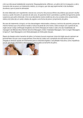 a ter sua vida sexual estabelecida novamente. Desgraçadamente, Jefferson, um pênis de 8 cm é pequeno, e até o
momento não se possui um tratamento médico, ou cirúrgico, que não seja experimental, e de resultados
duvidosos, que eu possa te admoestar.
Ao estar elaborado com ingredientes naturais seu consumo não provoca efeitos secundários que possam resultar
nocivos a saúde. Durante um período de sete anos, 42 pacientes foram submetidos a partilha do ligamento penile
suspensivo para pênis distensão. Uma nova descoberta mostra evidências de uma conexão entre comprimento
relativo do índice de um varão e dedos do argola e uma forma de prever comprimento do pênis.
No caso do tratamento cirúrgico, um dos desvantagens relacionados a doença, é anímico do paciente, porque da
mesma maneira que uma senhora recebe a notícia da perda de uma mama, varão se dique com a perda de seu
orgão sexual. Cobija certificação terapêutica do Centro Mutação em todas e cada uma das modalidades de
massagem do Método Deva Nishok (Sensitive Massagem, Enleio Totalidade Massagem, Yoni e Lingam Massagem,
G-Spot e P- Spot Massagem) e em Particularização em Disfunções Sexuais.
Depois de desejar evoluir tamanho do pênis, os homens buscam engrossar corpo do órgão sexual e pensam ser
possível fazer isso por uma cirurgia peniana. Esse sítio foi criado com o propósito de você tenha como ter
chegada as diversas opções de tratamentos para os distúrbios ligados a sexualidade masculina, como impotência
sexual, ejaculação adiantado e desvantagens relacionados ao tamanho do pênis.
 