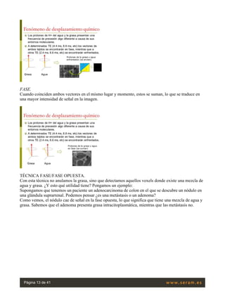 FASE.
Cuando coinciden ambos vectores en el mismo lugar y momento, estos se suman, lo que se traduce en
una mayor intensidad de señal en la imagen.
 
TÉCNICA FASE/FASE OPUESTA.
Con esta técnica no anulamos la grasa, sino que detectamos aquellos voxels donde existe una mezcla de
agua y grasa. ¿Y esto qué utilidad tiene? Pongamos un ejemplo:
Supongamos que tenemos un paciente un adenocarcinoma de colon en el que se descubre un nódulo en
una glándula suprarrenal. Podemos pensar ¿es una metástasis o un adenoma?
Como vemos, el nódulo cae de señal en la fase opuesta, lo que significa que tiene una mezcla de agua y
grasa. Sabemos que el adenoma presenta grasa intracitoplasmática, mientras que las metástasis no.
 
Página 13 de 41
 
