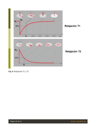 Fig. 6: Relajación T1 y T2.
Página 23 de 41
 