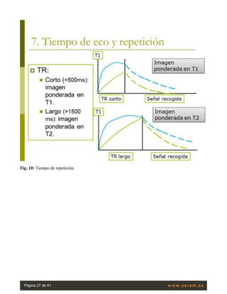 Fig. 10: Tiempo de repetición.
Página 27 de 41
 