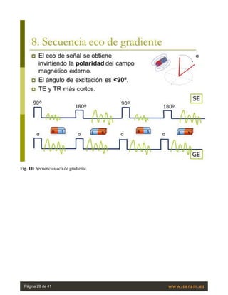 Fig. 11: Secuencias eco de gradiente.
Página 28 de 41
 