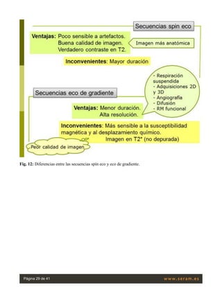 Fig. 12: Diferencias entre las secuencias spín eco y eco de gradiente.
Página 29 de 41
 