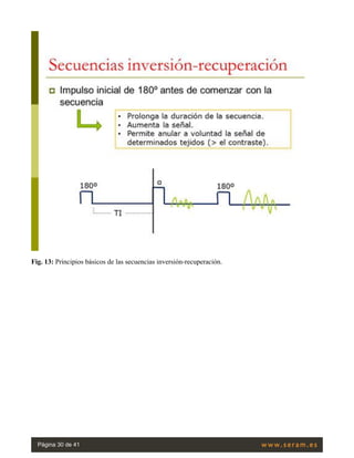 Fig. 13: Principios básicos de las secuencias inversión-recuperación.
Página 30 de 41
 