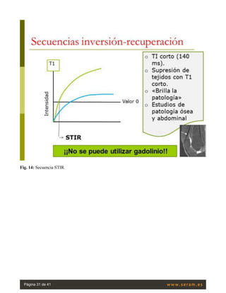 Fig. 14: Secuencia STIR.
Página 31 de 41
 