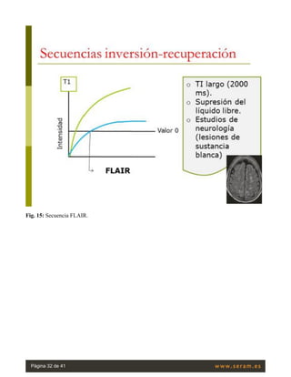 Fig. 15: Secuencia FLAIR.
Página 32 de 41
 