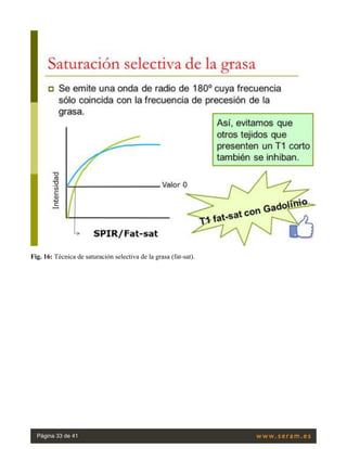 Fig. 16: Técnica de saturación selectiva de la grasa (fat-sat).
Página 33 de 41
 