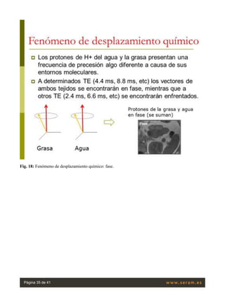 Fig. 18: Fenómeno de desplazamiento químico: fase.
Página 35 de 41
 