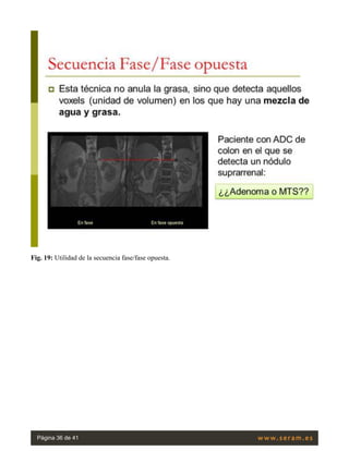 Fig. 19: Utilidad de la secuencia fase/fase opuesta.
Página 36 de 41
 