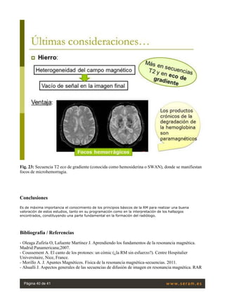 Fig. 23: Secuencia T2 eco de gradiente (conocida como hemosiderina o SWAN), donde se manifiestan
focos de microhemorragia.
Conclusiones
Es de máxima importancia el conocimiento de los principios básicos de la RM para realizar una buena
valoración de estos estudios, tanto en su programación como en la interpretación de los hallazgos
encontrados, constituyendo una parte fundamental en la formación del radiólogo.
Bibliografía / Referencias
- Oleaga Zufiría O, Lafuente Martínez J. Aprendiendo los fundamentos de la resonancia magnética.
Madrid:Panamericana;2007.
- Coussement A. El canto de los protones: un cómic (¿la RM sin esfuerzo?). Centre Hospitalier
Universitaire, Nice, France.
- Morillo A. J. Apuntes Magnéticos. Física de la resonancia magnética-secuencias. 2011.
- Ahualli J. Aspectos generales de las secuencias de difusión de imagen en resonancia magnética. RAR
Página 40 de 41
 