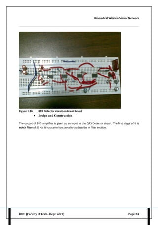 Biomedical Wireless Sensor Network
DDU (Faculty of Tech., Dept. of IT) Page 23
Figure 1.16 QRS Detector circuit on bread board
 Design and Construction
The output of ECG amplifier is given as an input to the QRS Detector circuit. The first stage of it is
notch filter of 50 Hz. It has same functionality as describe in filter section.
 