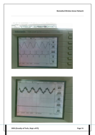 Biomedical Wireless Sensor Network
DDU (Faculty of Tech., Dept. of IT) Page 31
 