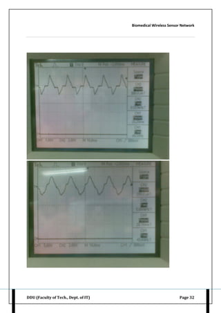 Biomedical Wireless Sensor Network
DDU (Faculty of Tech., Dept. of IT) Page 32
 