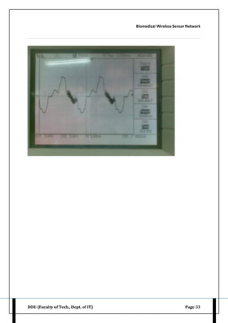 Biomedical Wireless Sensor Network
DDU (Faculty of Tech., Dept. of IT) Page 33
 