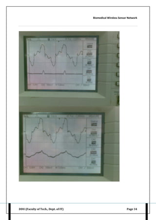 Biomedical Wireless Sensor Network
DDU (Faculty of Tech., Dept. of IT) Page 34
 