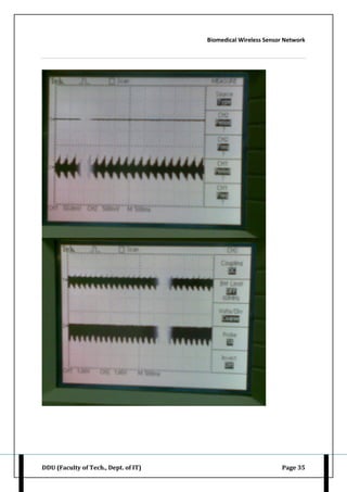 Biomedical Wireless Sensor Network
DDU (Faculty of Tech., Dept. of IT) Page 35
 