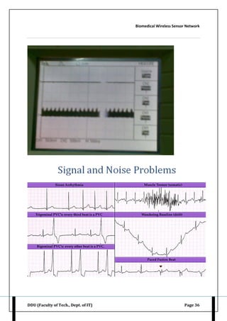 Biomedical Wireless Sensor Network
DDU (Faculty of Tech., Dept. of IT) Page 36
 