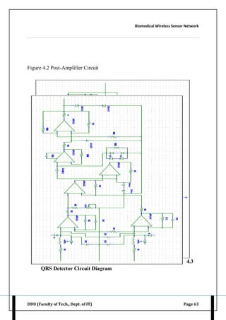 Biomedical Wireless Sensor Network
DDU (Faculty of Tech., Dept. of IT) Page 63
Figure 4.2 Post-Amplifier Circuit
4.3
QRS Detector Circuit Diagram
 