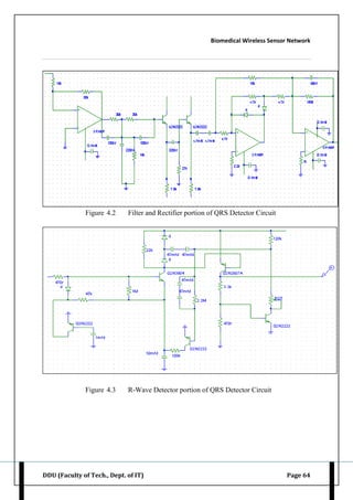 Biomedical Wireless Sensor Network
DDU (Faculty of Tech., Dept. of IT) Page 64
Figure 4.2 Filter and Rectifier portion of QRS Detector Circuit
Figure 4.3 R-Wave Detector portion of QRS Detector Circuit
 