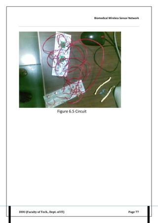 Biomedical Wireless Sensor Network
DDU (Faculty of Tech., Dept. of IT) Page 77
Figure 6.5 Circuit
 