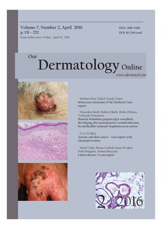 Volume 7, Number 2, April 2016 ISSN: 2081-9390
p. 131 - 252 DOI: 10.7241/ourd
Issue online since Friday, April 01, 2016
DermatologyOnline
www.odermatol.com
Our
- Mehmet Eren Yuksel, Funda Tamer
Sebaceous carcinoma of the forehead: Case
report
- Masataka Satoh, Hideko Okabe, Reiko Orikasa,
Toshiyuki Yamamoto
Henoch-Schönlein purpura (IgA vasculitis)
developing after postoperative wound infection
by methicillin-resistant Staphylococcus aureus
- Uwe Wollina
Arsenic and skin cancer – case report with
chemoprevention
- Manel Yahia, Besma Laabidi, Issam M’sakni,
Fethi Bougrine, Ammar Bouziani
Lafora disease: A case report
2 / 2016
 